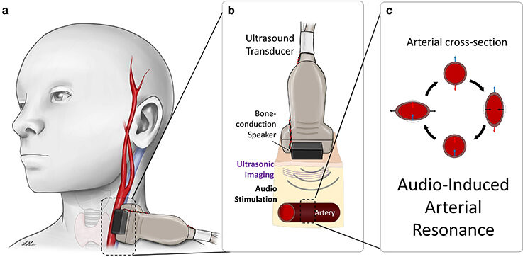 What new sensing approaches measure blood pressure?